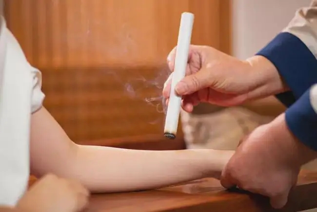 艾灸和拔罐的注意事項！